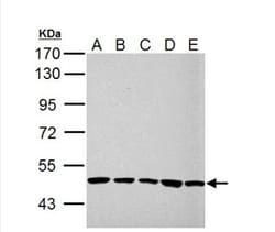 UQCRC1 Antibody, Novus Biologicals 0.1mL; Unlabeled:Antibodies, Polyclonal