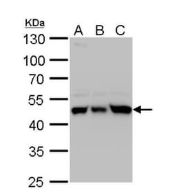 UQCRC1 Antibody, Novus Biologicals 0.1mL; Unlabeled:Antibodies, Polyclonal