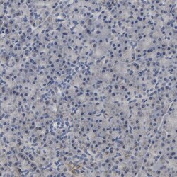 UQCRC2 Antibody, Novus Biologicals:Antibodies:Primary Antibodies