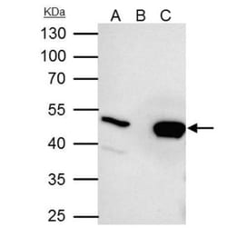 UQCRC2 Antibody, Novus Biologicals 0.1mL; Unlabeled:Antibodies, Polyclonal