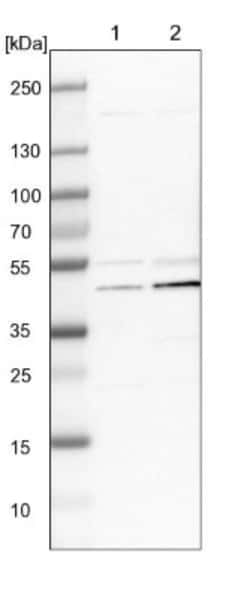 UQCRC2 Antibody, Novus Biologicals:Antibodies:Primary Antibodies