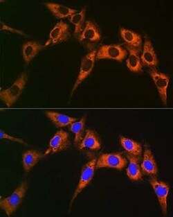 UQCRFS1 Rabbit anti-Human, Mouse, Rat, Clone: 0O9Z10, Novus Biologicals 100 &mu;g | Buy Online | Novus Biologicals | Fisher Scientific