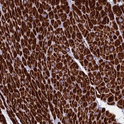 UQCRFS1 Antibody, Novus Biologicals 25 &mu;L | Buy Online | Novus Biologicals | Fisher Scientific