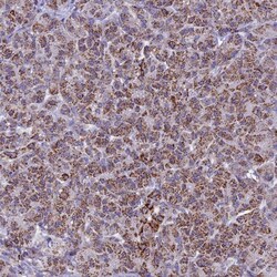 UQCRFS1 Antibody, Novus Biologicals 25 &mu;L | Buy Online | Novus Biologicals | Fisher Scientific