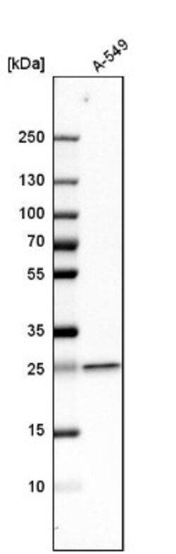 UQCRFS1 Antibody, Novus Biologicals 25 &mu;L | Buy Online | Novus Biologicals | Fisher Scientific