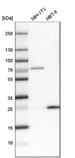 UQCRFS1 Antibody, Novus Biologicals 25 &mu;L | Buy Online | Novus Biologicals | Fisher Scientific