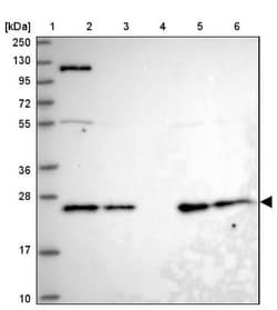 UQCRFS1 Antibody, Novus Biologicals:Antibodies:Primary Antibodies