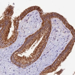 UQCRQ Antibody, Novus Biologicals 0.1mL; Unlabeled:Antibodies, Polyclonal