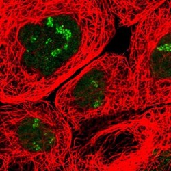 URB1 Antibody, Novus Biologicals:Antibodies:Primary Antibodies