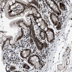 URB1 Antibody, Novus Biologicals:Antibodies:Primary Antibodies