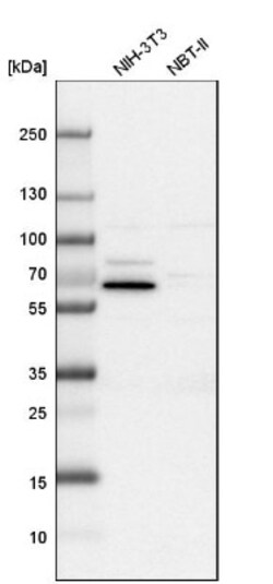 USH1C Antibody, Novus Biologicals:Antibodies:Primary Antibodies