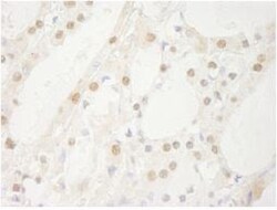 USP1 Antibody, Novus Biologicals 0.1mL; Unlabeled:Antibodies, Polyclonal