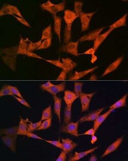 USP10 Rabbit anti-Human, Mouse, Clone: 9L6F3, Novus Biologicals 100 &mu;g | Buy Online | Novus Biologicals | Fisher Scientific