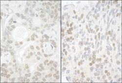 USP13 Antibody, Novus Biologicals 0.1mg; Unlabeled:Antibodies, Polyclonal