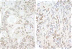 USP13 Antibody, Novus Biologicals 0.1mg; Unlabeled:Antibodies, Polyclonal