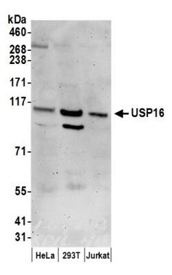 USP16 Antibody, Novus Biologicals 0.1mg; Unlabeled:Antibodies, Polyclonal