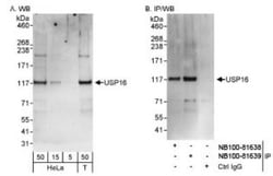 USP16 Antibody, Novus Biologicals 0.1mL; Unlabeled:Antibodies, Polyclonal