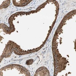 USP2 Antibody, Novus Biologicals 0.1mL; Unlabeled:Antibodies, Polyclonal