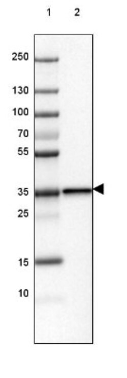 USP2 Antibody, Novus Biologicals 0.1mL; Unlabeled:Antibodies, Polyclonal