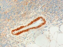 USP20 Antibody, Novus Biologicals 0.1mg; Unlabeled:Antibodies, Polyclonal