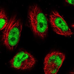 USP22 Antibody, Novus Biologicals:Antibodies:Primary Antibodies