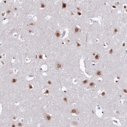 USP22 Antibody, Novus Biologicals:Antibodies:Primary Antibodies