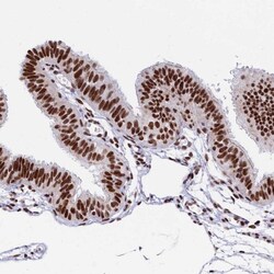 USP22 Antibody, Novus Biologicals:Antibodies:Primary Antibodies