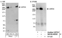USP24 Antibody, Novus Biologicals 0.1mg; Unlabeled:Antibodies, Polyclonal