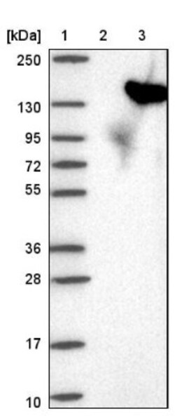 USP25 Antibody, Novus Biologicals 0.1mL; Unlabeled:Antibodies, Polyclonal