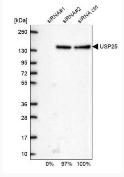 USP25 Antibody, Novus Biologicals 0.1mL; Unlabeled:Antibodies, Polyclonal