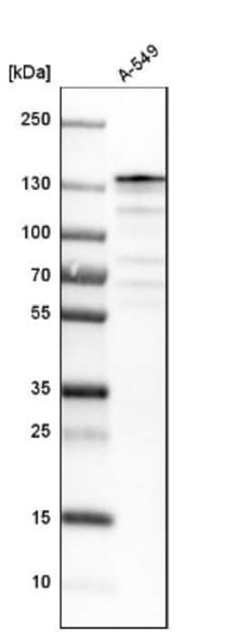 USP28 Antibody, Novus Biologicals 25 &mu;L; Unlabeled:Antibodies, Polyclonal