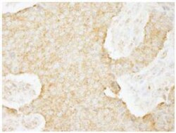 USP3 Antibody, Novus Biologicals 0.1mg; Unlabeled:Antibodies, Polyclonal