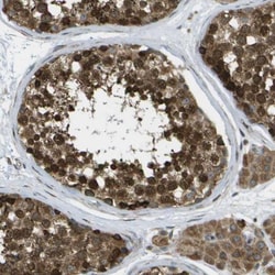 USP30 Antibody, Novus Biologicals 0.1mL; Unlabeled:Antibodies, Polyclonal