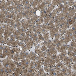 USP30 Antibody, Novus Biologicals 0.1mL; Unlabeled:Antibodies, Polyclonal