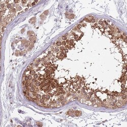 USP32 Antibody, Novus Biologicals:Antibodies:Primary Antibodies
