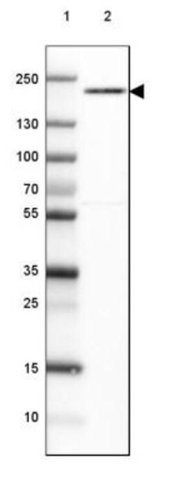 USP32 Antibody, Novus Biologicals:Antibodies:Primary Antibodies