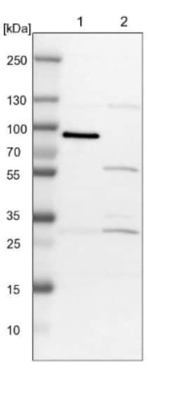 USP33 Antibody, Novus Biologicals 0.1mL; Unlabeled:Antibodies, Polyclonal
