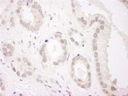 USP34 Antibody, Novus Biologicals 0.1mL; Unlabeled:Antibodies, Polyclonal