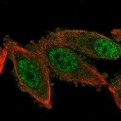 anti-USP38, Polyclonal, Novus Biologicals 0.1mL; Unlabeled:Antibodies,