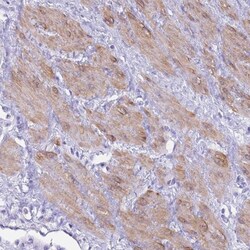 anti-USP38, Polyclonal, Novus Biologicals 0.1mL; Unlabeled:Antibodies,