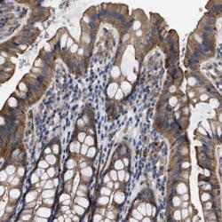 KIF2B Antibody, Novus Biologicals:Antibodies:Primary Antibodies