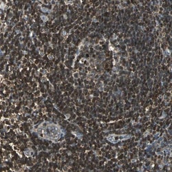 USP40 Antibody, Novus Biologicals 0.1mL; Unlabeled:Antibodies, Polyclonal