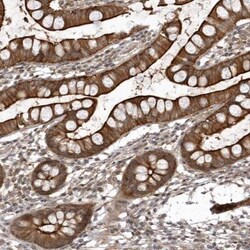 anti-USP43, Polyclonal, Novus Biologicals 0.1mL; Unlabeled:Antibodies,
