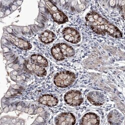 USP45 Antibody, Novus Biologicals:Antibodies:Primary Antibodies