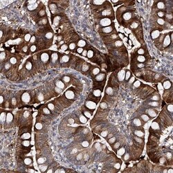 USP45 Antibody, Novus Biologicals 0.1mL; Unlabeled:Antibodies, Polyclonal