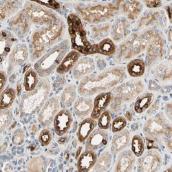 USP46 Antibody, Novus Biologicals:Antibodies:Primary Antibodies