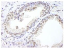 USP47 Antibody, Novus Biologicals 0.1mg; Unlabeled:Antibodies, Polyclonal