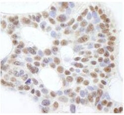 USP47 Antibody, Novus Biologicals 0.1mg; Unlabeled:Antibodies, Polyclonal