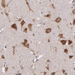 USP51 Antibody, Novus Biologicals 25 &mu;L | Buy Online | Novus Biologicals | Fisher Scientific