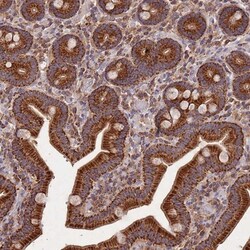 USP54 Antibody, Novus Biologicals 25 &mu;L, Unlabeled:Anticuerpos